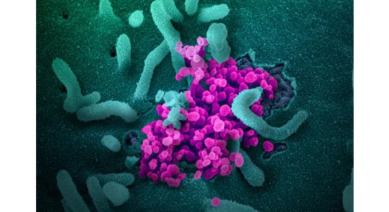 Учёные из Италии назвали фактическую смертность от коронавируса