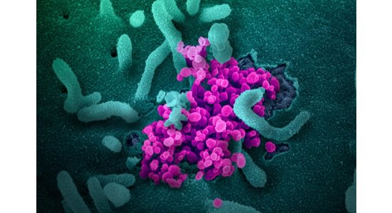 Учёные из Италии назвали фактическую смертность от коронавируса